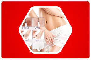 Private Part whitening Cream